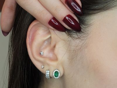 Carol Tannure Acupuntura